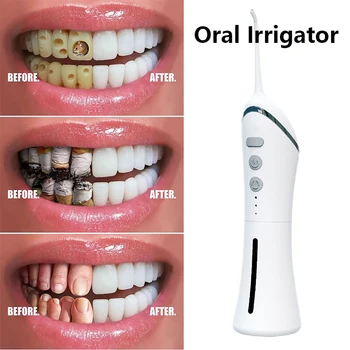 Irrigador Oral Dental Portátil de Água Flosser Recarregável USB Limpador de Fio dental Oral Cuidados Ortodônticos Jato de Água os Dentes mais