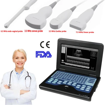 CMS600P2 CONTEC Portátil Máquina de ultra-som B ultra-Sônica de Sistemas de Scanner Opcional Convexo Cardíaca Endo-vaginal Sonda Linear
